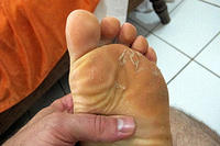I got some kind of Amazon foot fungus while in the jungle.jpg